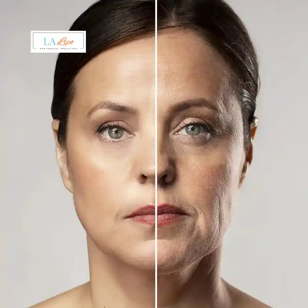 How Can You Tell If Non-Surgical Skin Tightening Is Right for You Kington?