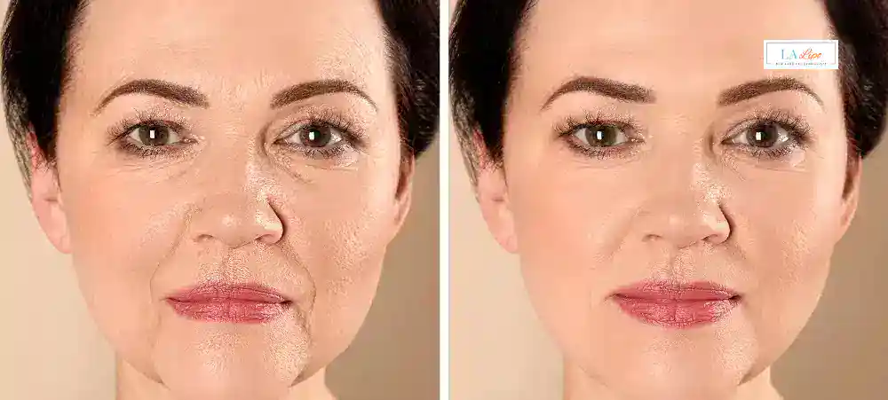 Why Aren’t My Skincare Products Making My Sagging Skin Look Firmer Kington?