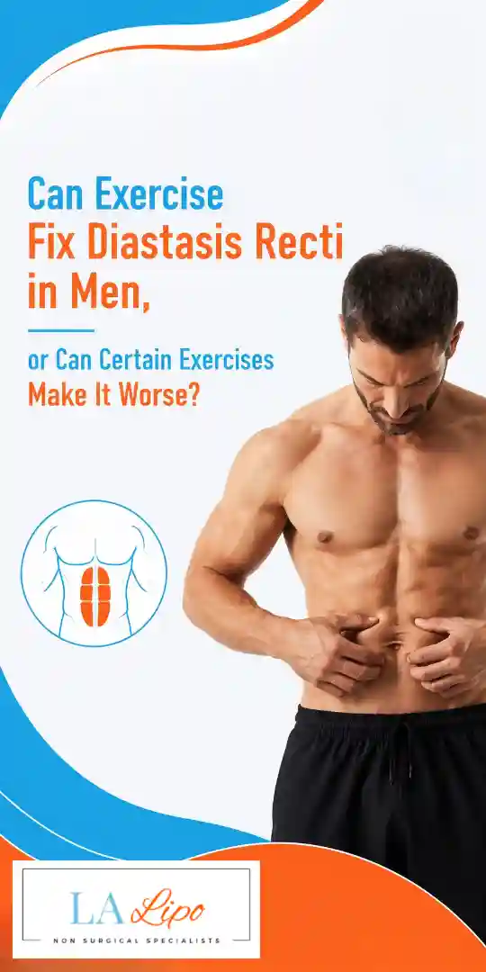 Can Exercise Fix Diastasis Recti in Men, or Can Certain Exercises Make It Worse Kington?